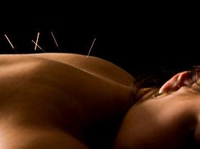 ACUPUNCTURE CHRISTCHURCH